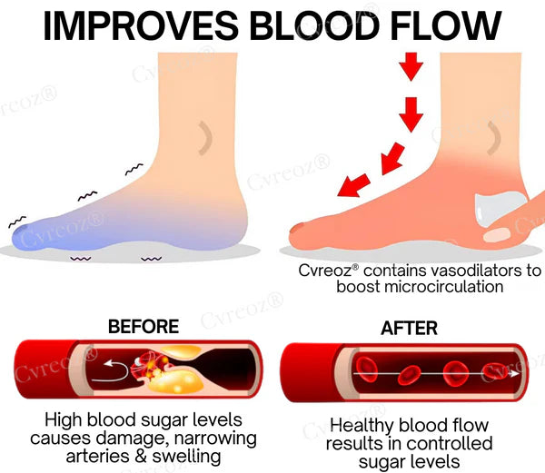 LIMITED TIME SALE OFF 60% 🔥CVREOZ® BioVitaGlyco Diabetes Treatment Cream