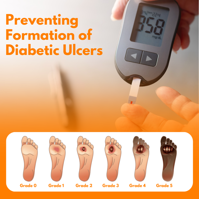 CVREOZ® Bee Venom Diabetic Wound Spray