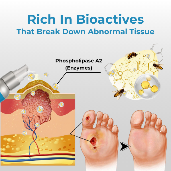 đSPECIAL OFFER: 60% Today Only!đ„CVREOZÂź VitaHeal Bee Venom Diabetic Treatment Spray