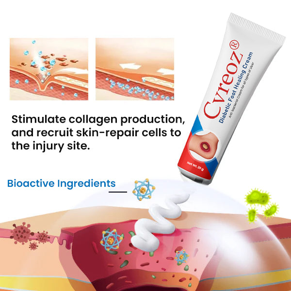 ⏰Last Day Promotion: 70% OFF 🔥Cvreoz® Diabetic Foot Healing Cream