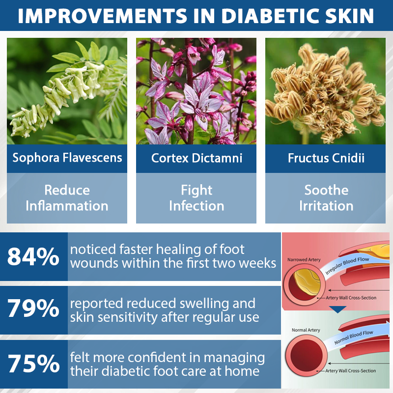 CVREOZ® Diabetes Foot Guard Fast Recovery Spray