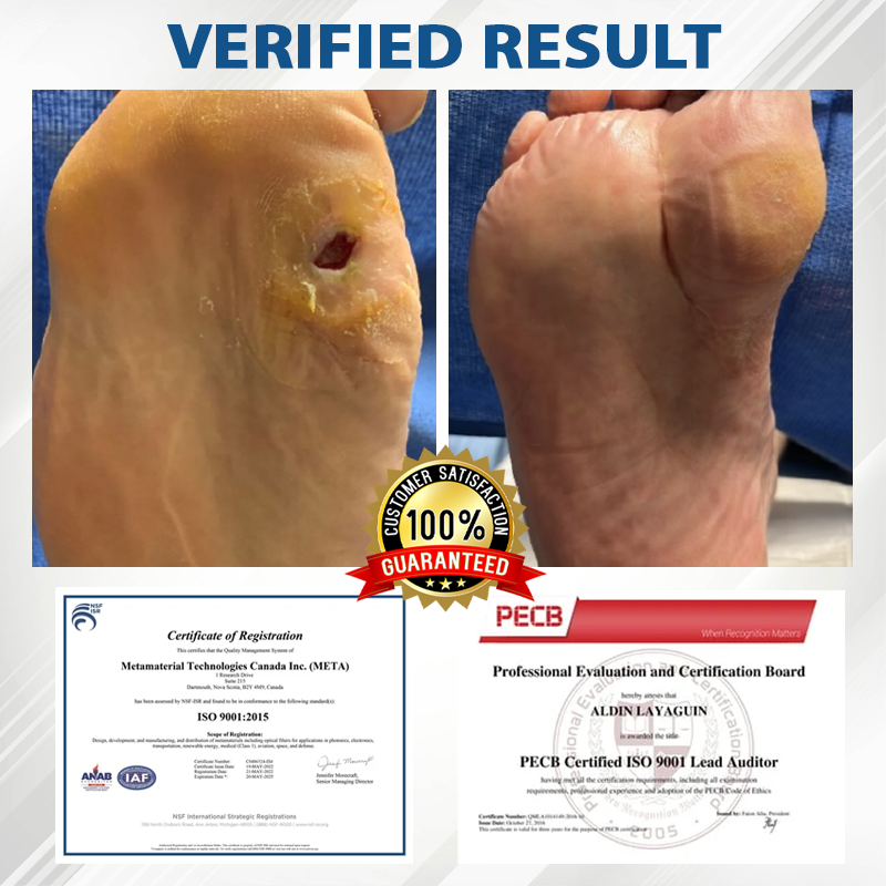 CVREOZ® Diabetes Foot Guard Fast Recovery Spray