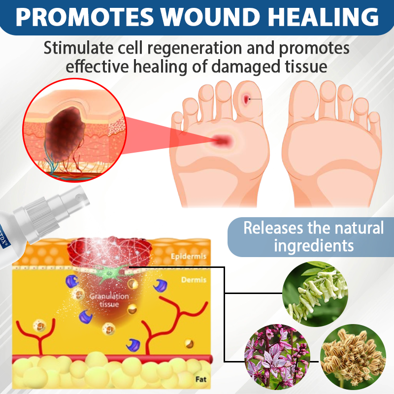 CVREOZ® Diabetes Foot Guard Fast Recovery Spray