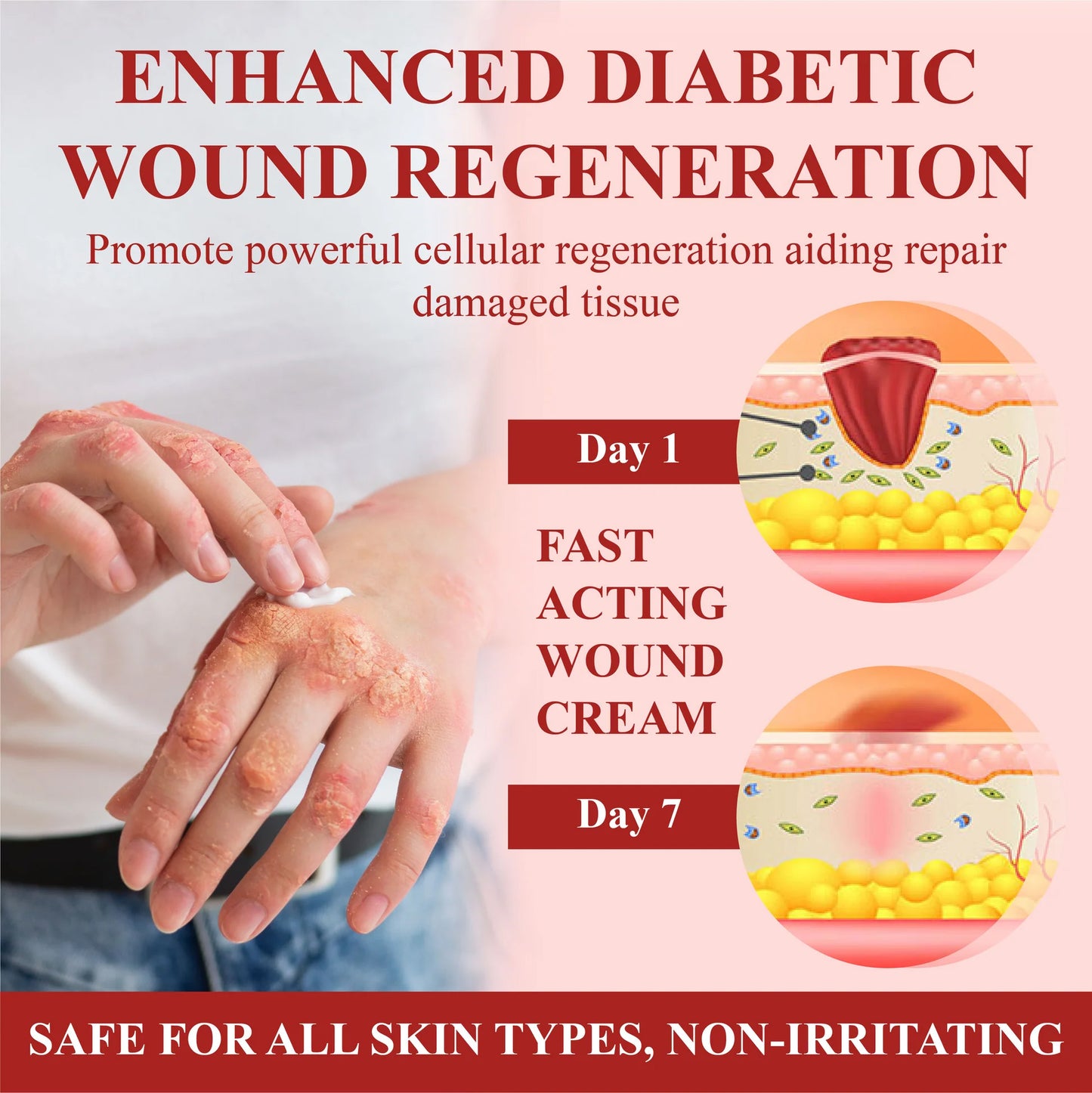 ⏰Last Day Promotion: 60% OFF 🔥CVREOZ® GlucoseGuard Skin Rescue Cream