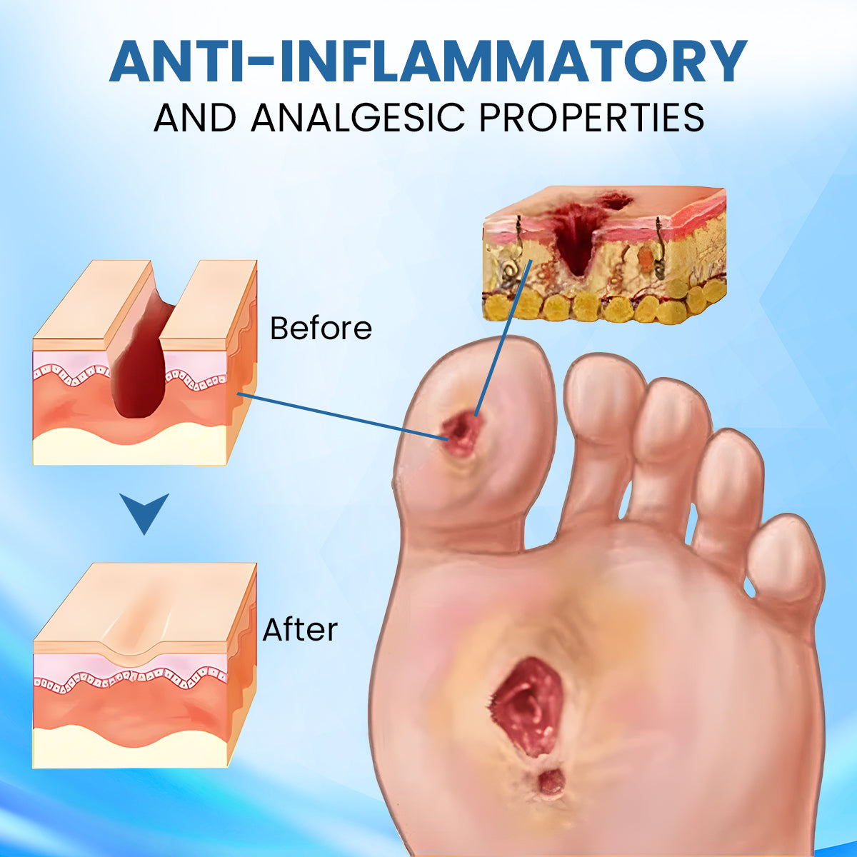 ⏰Last Day Promotion: 60% OFF 🔥Cvreoz® Diabetic Foot Healing Cream