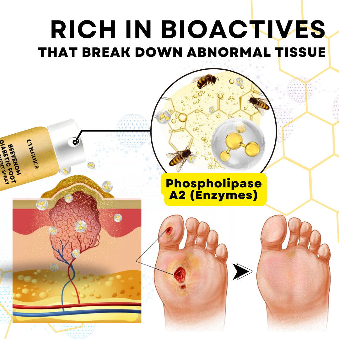 đSPECIAL OFFER: 60% OFF This Today Only!đ„CVREOZÂź Bee Venom Diabetic Foot Treatment Spray