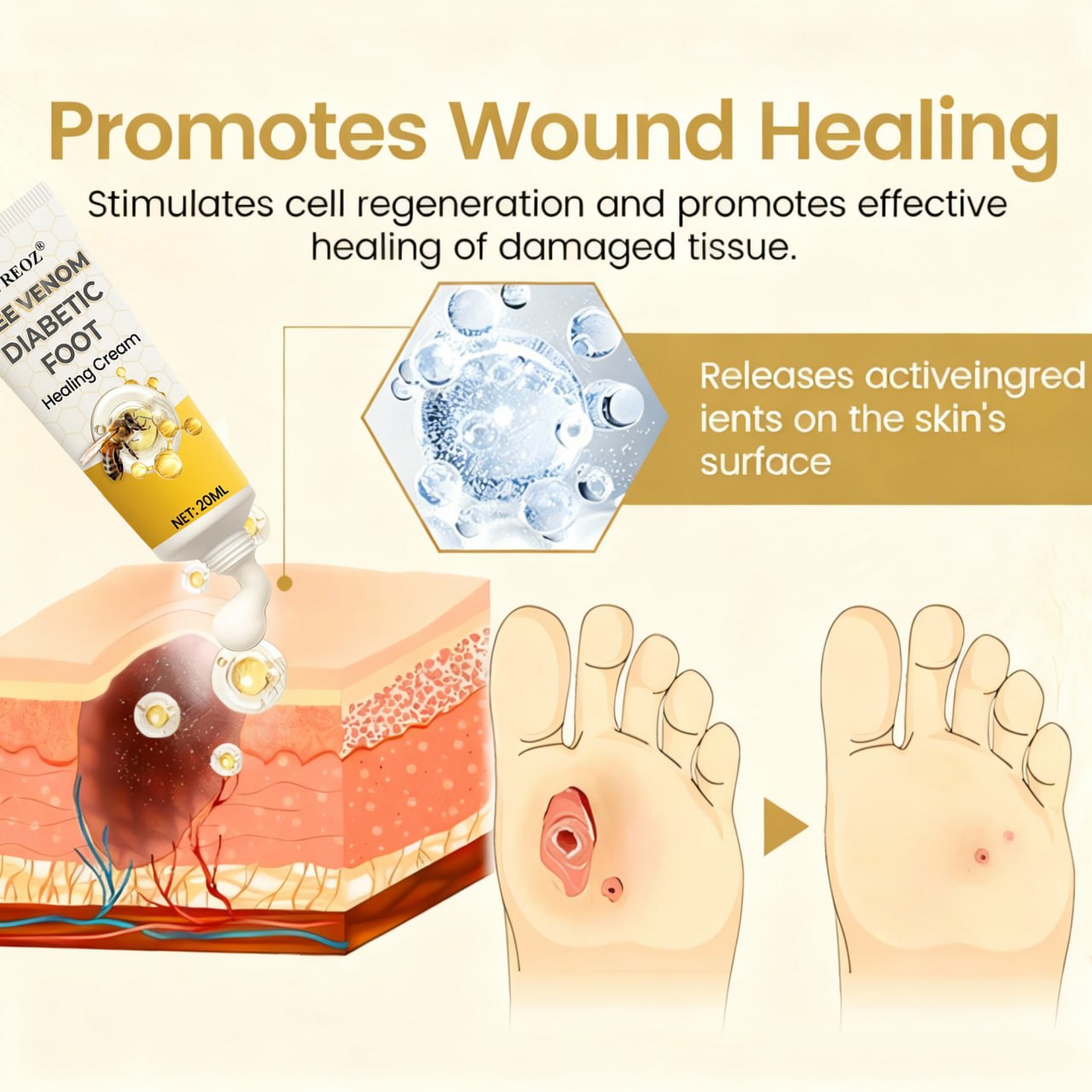 🎉SPECIAL OFFER: 60% OFF🔥 8M+ SOLD️🏆 CVREOZ® Bee Venom Diabetic Foot Healing Cream