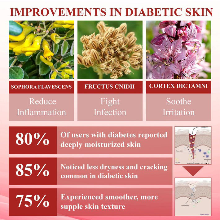 ⏰Last Day Promotion: 60% OFF 🔥CVREOZ® GlucoseGuard Skin Rescue Cream