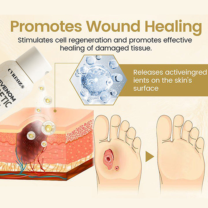 🎉SPECIAL OFFER: 60% OFF This Today Only!🔥 CVREOZ® Bee Venom Diabetic Foot Healing Spray