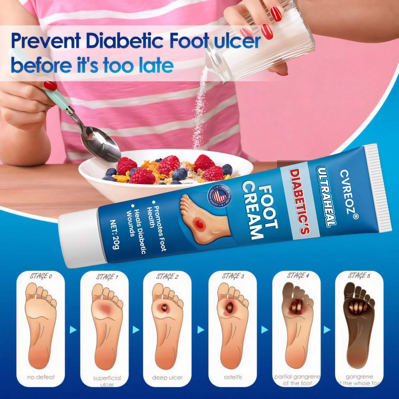 đ„ Special Deal: 60% OFF + Free Shipping âš CVREOZÂź UltraHeal Diabetic's Foot Cream