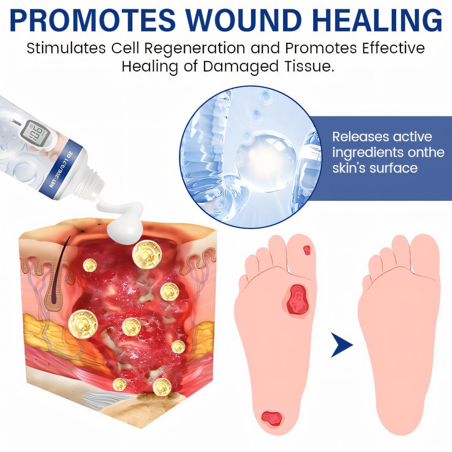 đ„Special Offer â 60% OFF This Week Onlyâ°: CvreozÂź GlucoRelief Diabetic Treatment Cream