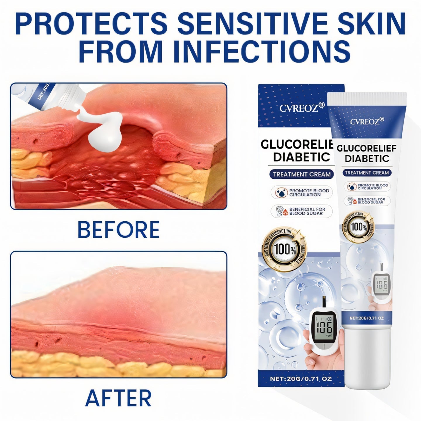 đ„Special Offer â 60% OFF This Week Onlyâ°: CvreozÂź GlucoRelief Diabetic Treatment Cream