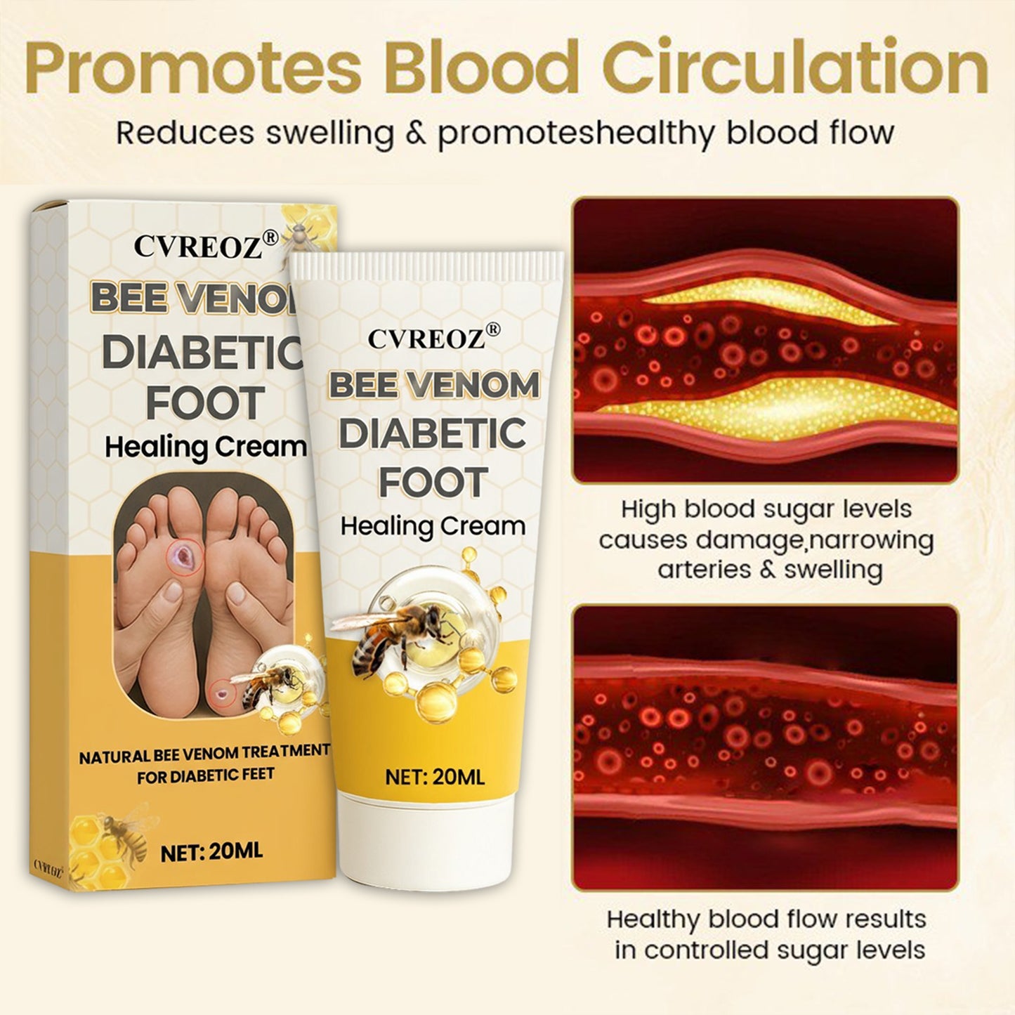 🎉SPECIAL OFFER: 60% OFF🔥 8M+ SOLD️🏆 CVREOZ® Bee Venom Diabetic Foot Healing Cream