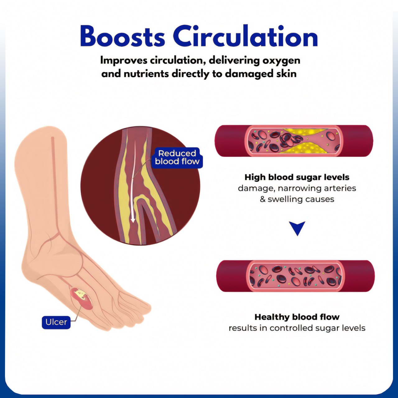 ⏰Last Day Promotion: 60% OFF🔥Crveoz® VenHeal Diabetic Wound Cream.