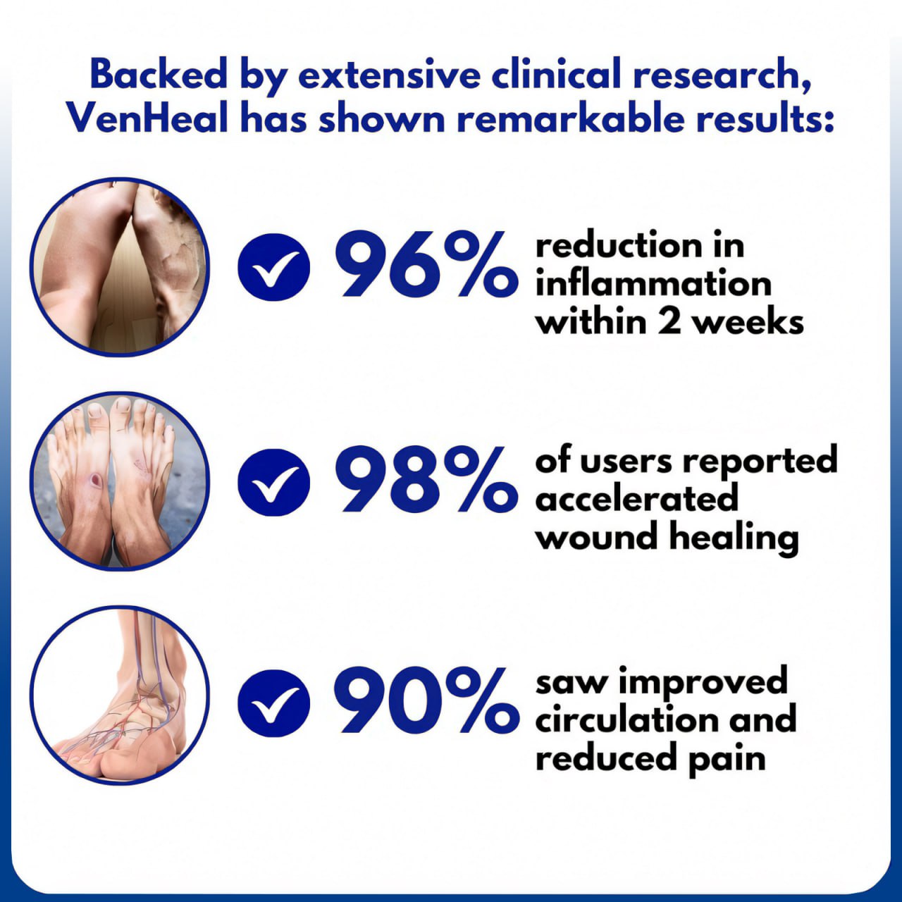 ⏰Last Day Promotion: 60% OFF🔥Crveoz® VenHeal Diabetic Wound Cream.