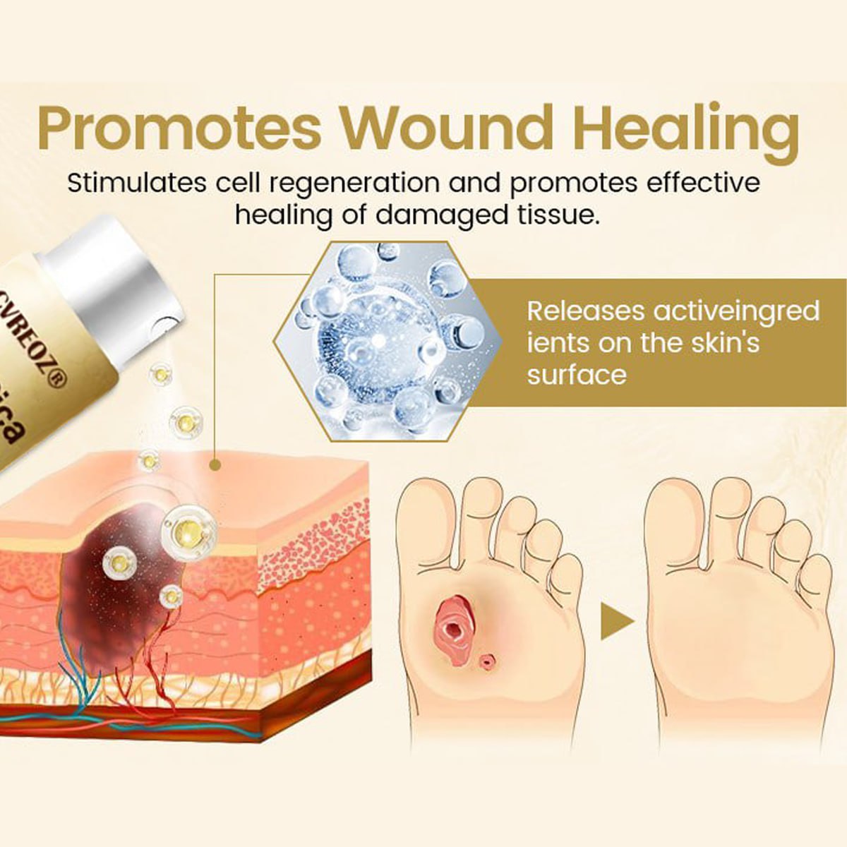 CVREOZ® DiaCure Bee Venom & Centella Diabetic Foot Ulcer Spray 🔥