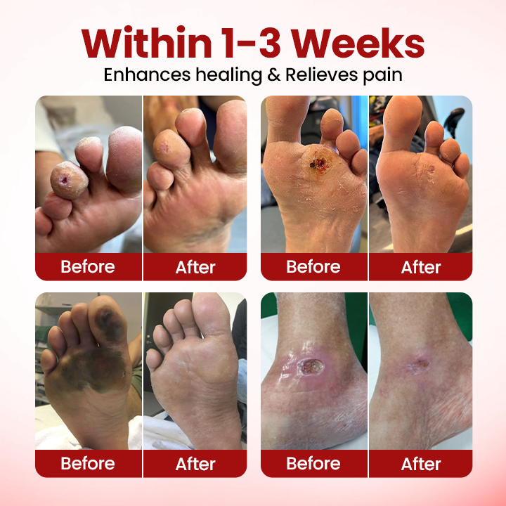 Healrize® FootGuard Diabetic Care Cream