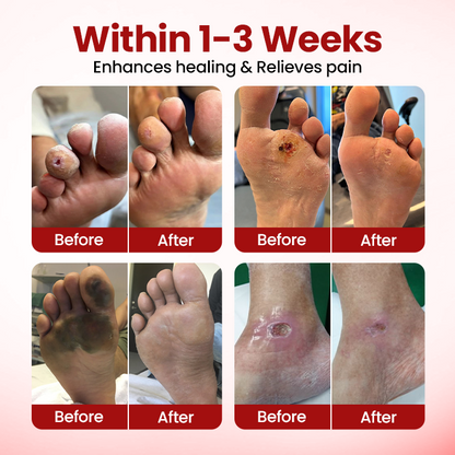 Healrize® FootGuard Diabetic Care Cream