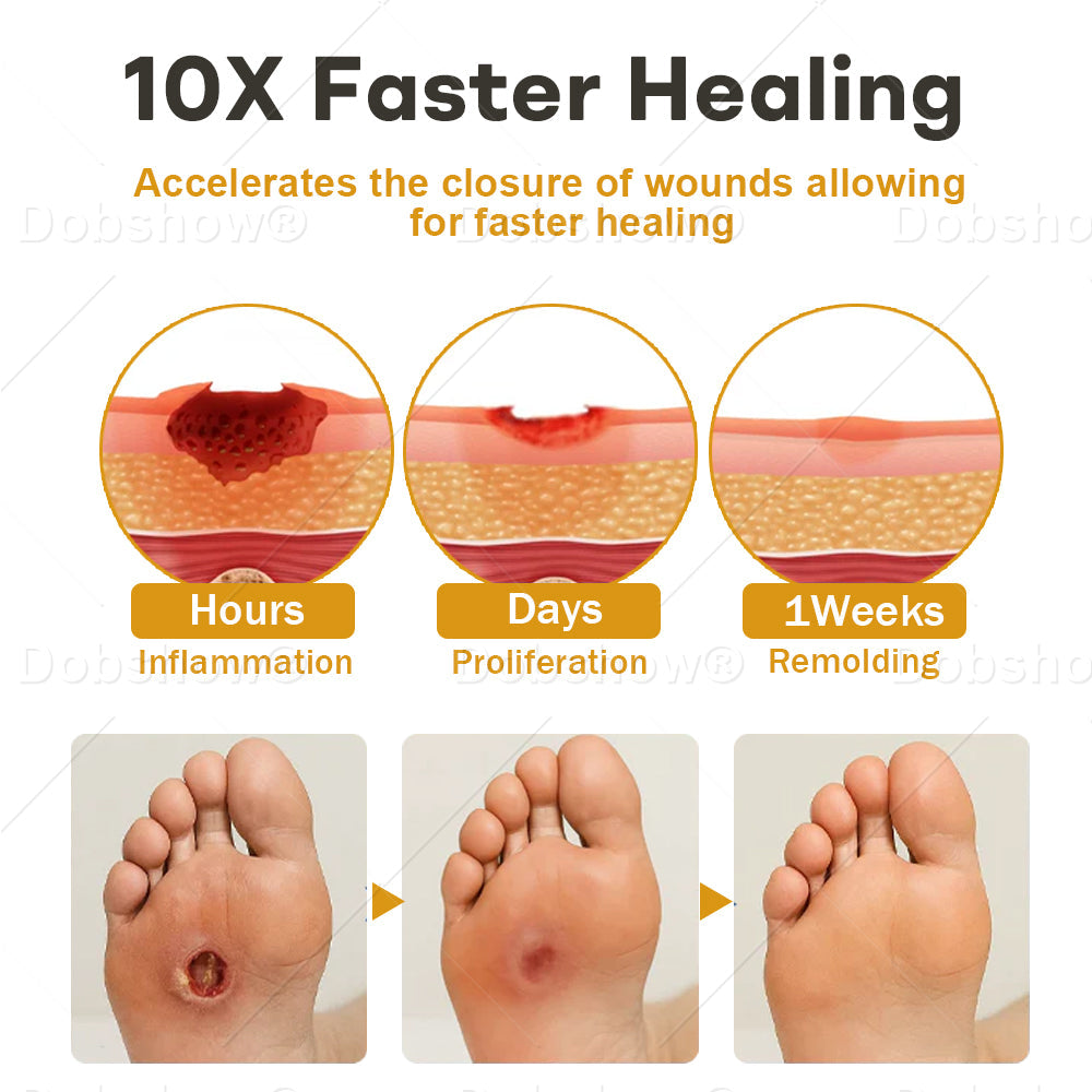 Healrize® GlucoShield Bee Venom Wound Spray