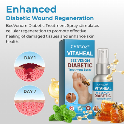 🎉SPECIAL OFFER: 60% Today Only!🔥CVREOZ® VitaHeal Bee Venom Diabetic Treatment Spray