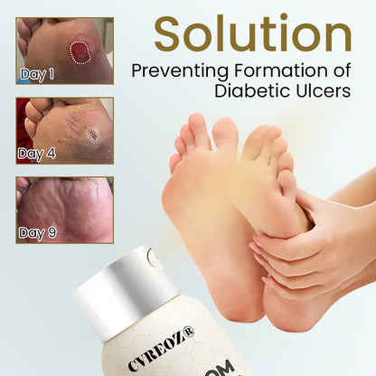 🔥HOT SALE 60% OFF✨ CVREOZ® Bee Venom Diabetic Foot Healing Spray
