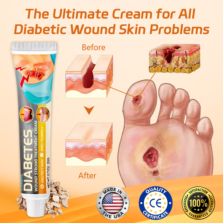 ⏰Last Day Promotion: 60% OFF🔥 Cvreoz® Diabetes Wound Strong Treatment Cream