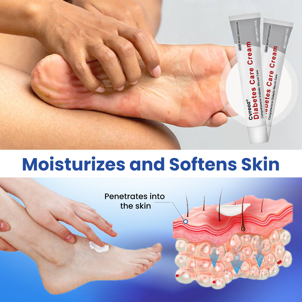 ✨[Official Store]✨ Cvreoz® Diabetes Care Cream