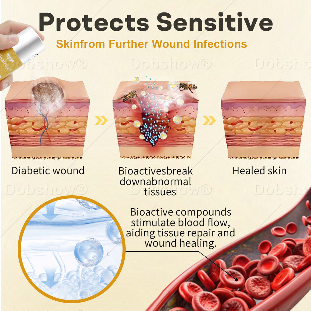 Healrize® GlucoShield Bee Venom Wound Spray