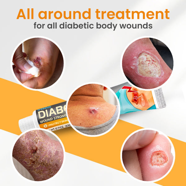 ⏰Last Day Promotion: 60% OFF🔥 Cvreoz® Diabetes Wound Strong Treatment Cream