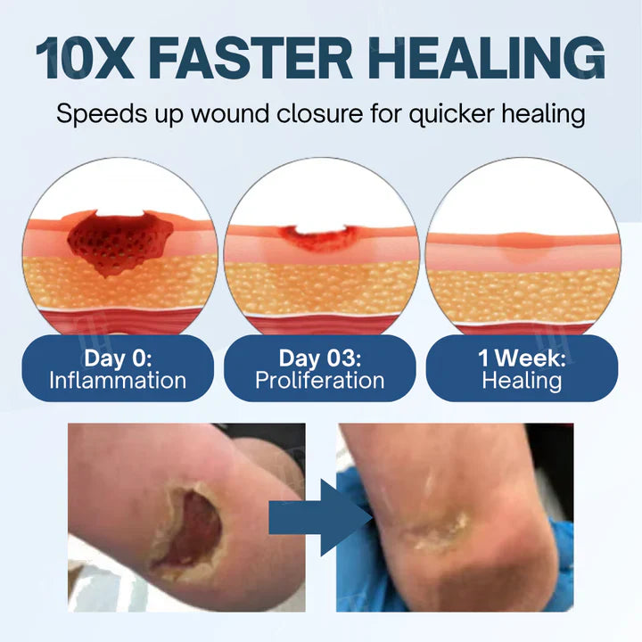 Healrize® Ulcer-Relief Diabetes Treatment Cream