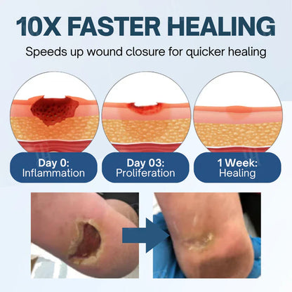 Healrize® Ulcer-Relief Diabetes Treatment Cream