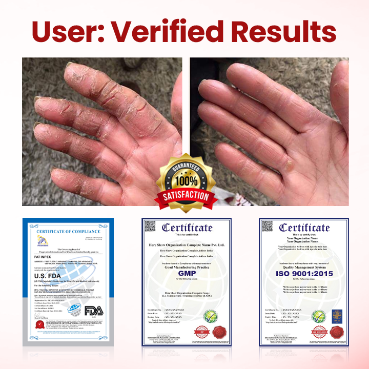 Healrize® FootGuard Diabetic Care Cream