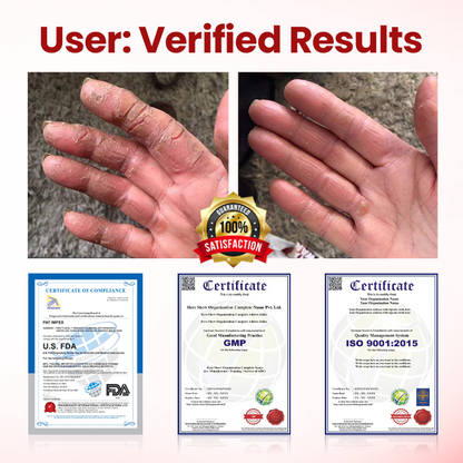 CVREOZ® DiaCare Diabetic Treatment Cream