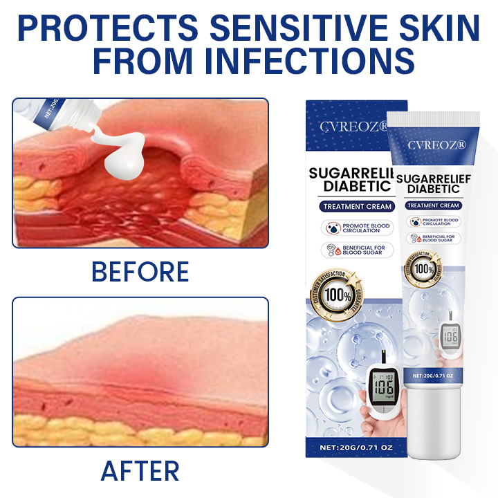 Cvreoz® SugarRelief Diabetic Treatment Cream