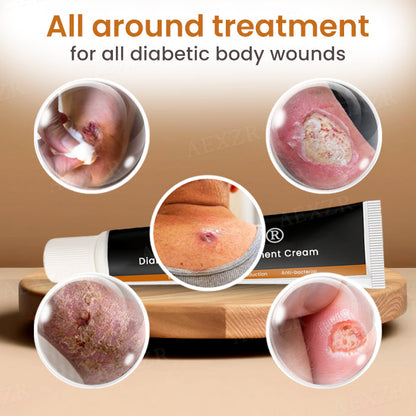 ⏰Last Day Promotion: 60% OFF🔥 Cvreoz® Advanced Wound Healing Cream for Diabetic Skin