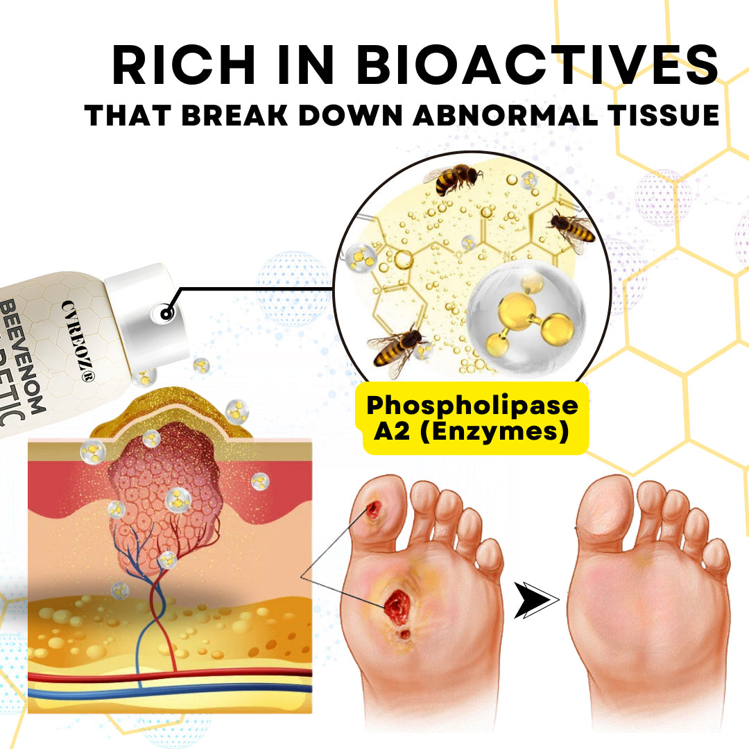 🔥HOT SALE 60% OFF✨ CVREOZ® Bee Venom Diabetic Foot Healing Spray