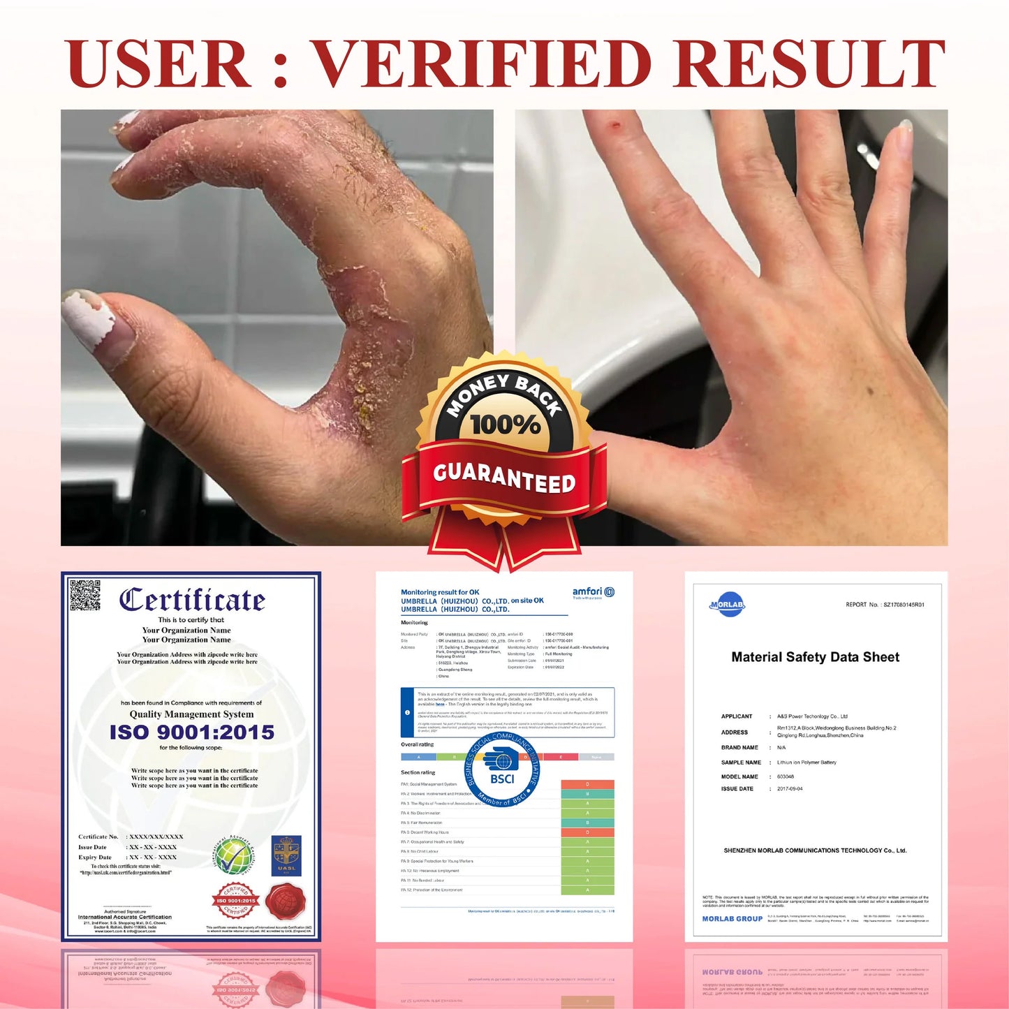 🎉SPECIAL OFFER: 60% OFF This Today Only!🔥 CVREOZ® GlucoseGuard Skin Rescue Cream