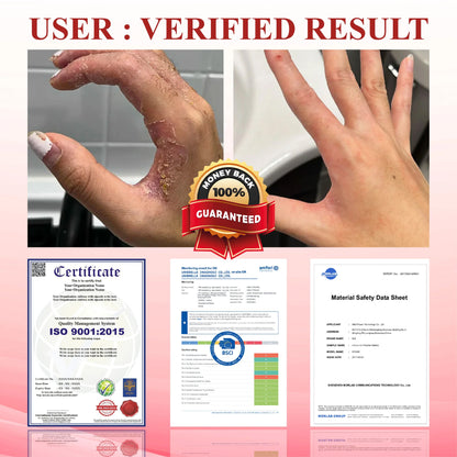 🎉SPECIAL OFFER: 60% OFF This Today Only!🔥 CVREOZ® GlucoseGuard Skin Rescue Cream