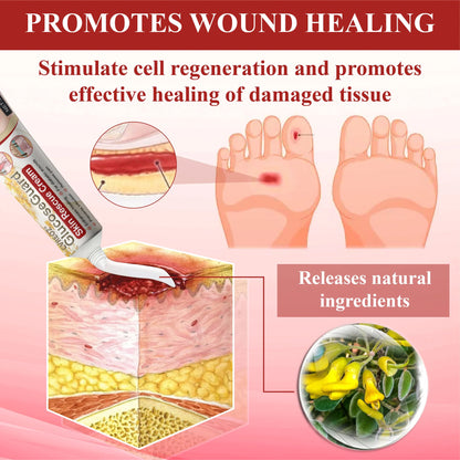 🎉SPECIAL OFFER: 60% OFF This Today Only!🔥 CVREOZ® GlucoseGuard Skin Rescue Cream