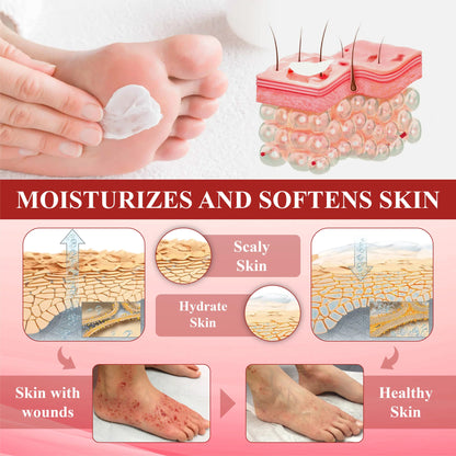 🎉SPECIAL OFFER: 60% OFF This Today Only!🔥 CVREOZ® GlucoseGuard Skin Rescue Cream