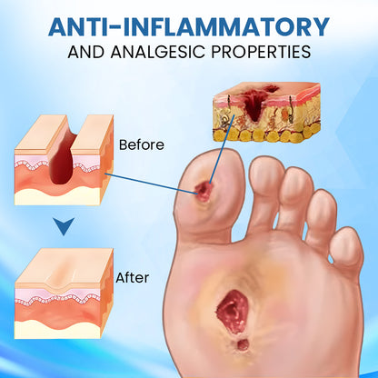 ⏰Last Day Promotion: 70% OFF 🔥Cvreoz® Diabetic Foot Healing Cream