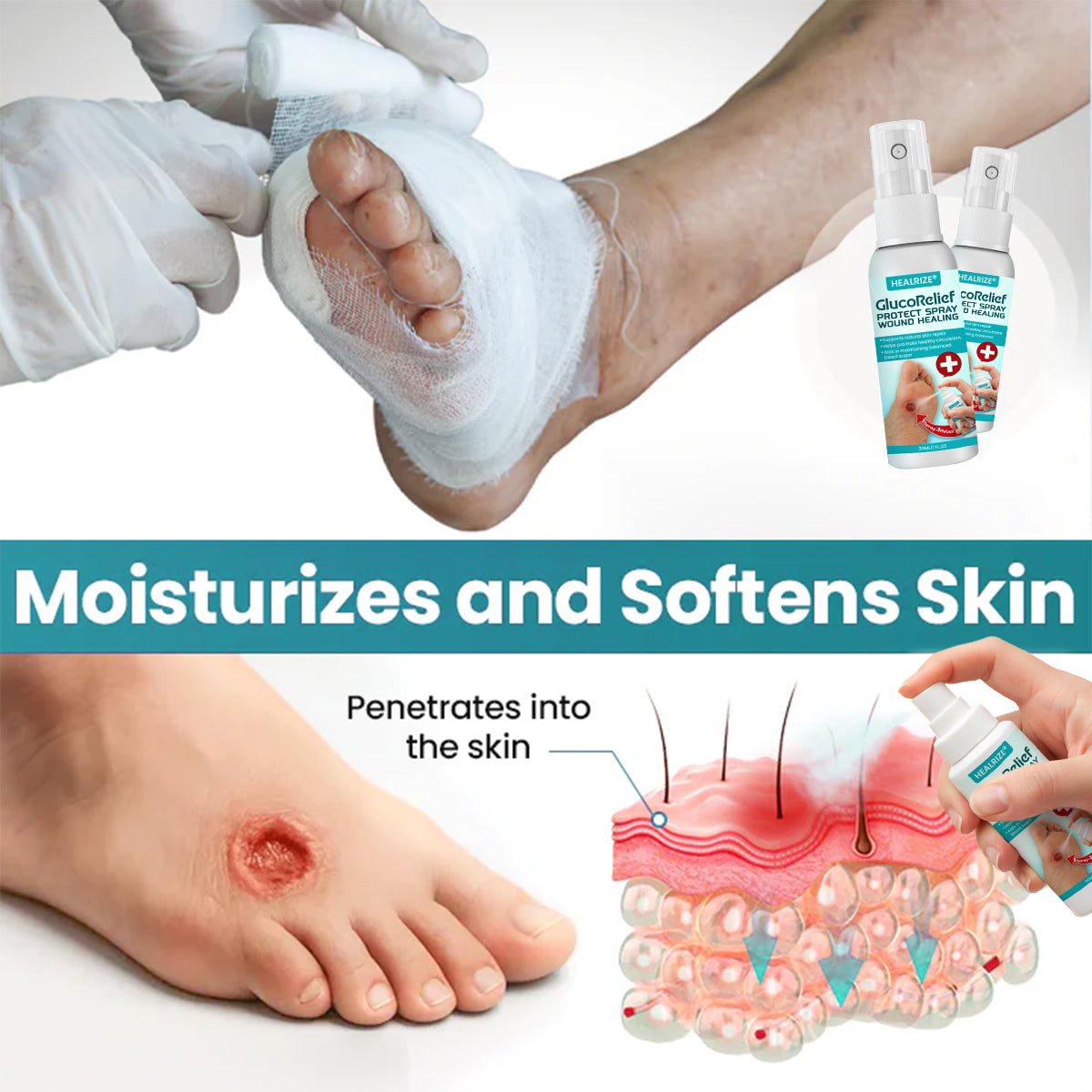 ⏰ EXCLUSIVE DEAL 60% OFF🔥Healrize® GlucoRelief Protect Spray Wound Healing