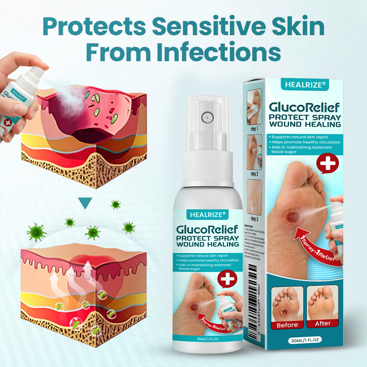 ⏰ EXCLUSIVE DEAL 60% OFF🔥Healrize® GlucoRelief Protect Spray Wound Healing