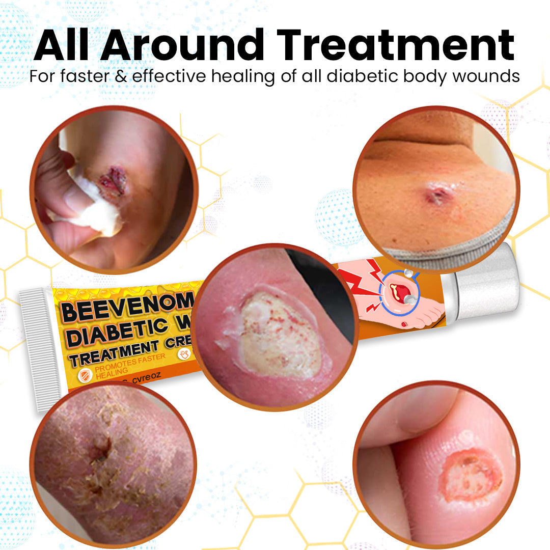 Cvreoz® Bee Venom Diabetic Wounds Treatment Cream