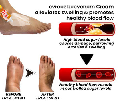 Cvreoz® Bee Venom Diabetic Wounds Treatment Cream