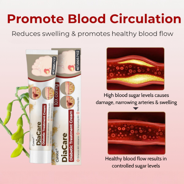 🔥Flash Deal: 60% OFF Today ONLY!🔥CVREOZ® DiaCare Diabetic Treatment Cream