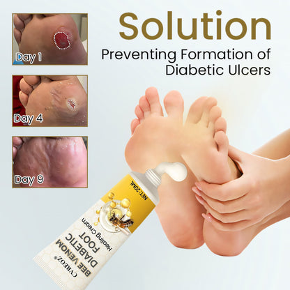 🎉SPECIAL OFFER: 60% OFF🔥 8M+ SOLD️🏆 CVREOZ® Bee Venom Diabetic Foot Healing Cream