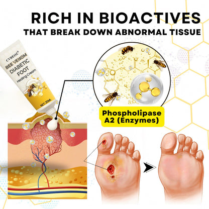 🎉SPECIAL OFFER: 60% OFF🔥 8M+ SOLD️🏆 CVREOZ® Bee Venom Diabetic Foot Healing Cream