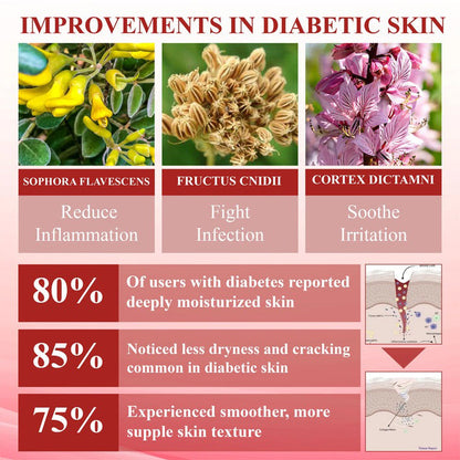 🎉SPECIAL OFFER: 60% OFF This Today Only!🔥 CVREOZ® GlucoseGuard Skin Rescue Cream