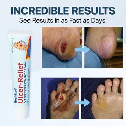 Healrize® Ulcer-Relief Diabetes Treatment Cream